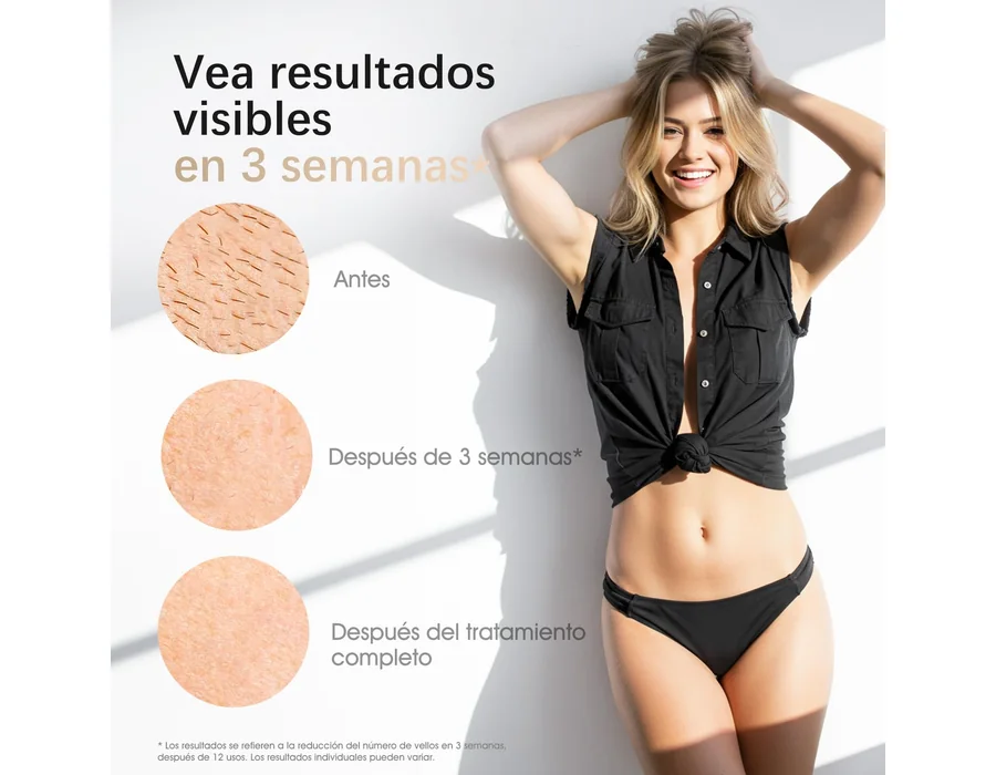 Haarlosy Depiladora Laser IPL con Refrigeración para Mujer y Hombre, GLY07 foto 3