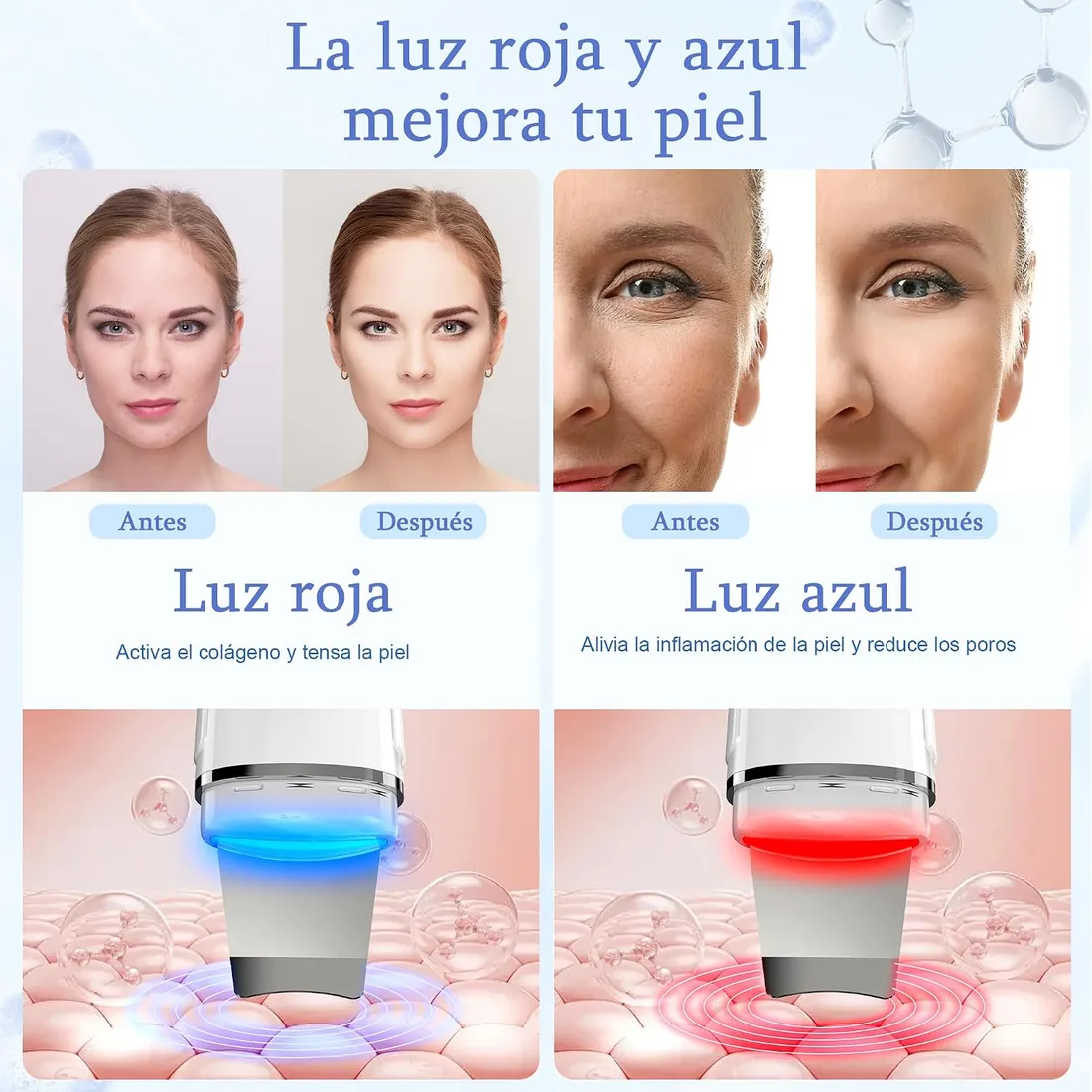 Peeling Ultrasónico Facial, 4 Modos y Luz Azul Roja | Limpiador Ultrasónico Facial, Skin Scrubber Removedor de Puntos Negros, Dispositivo de Belleza foto 3